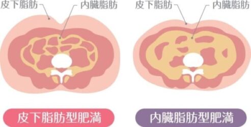 内臓脂肪を減らす運動と食事のポイント